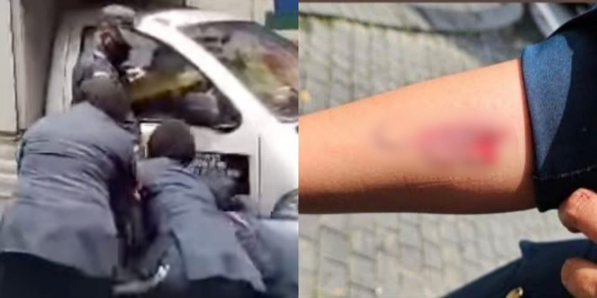 Penguatkuasa DBKL Cedera, Kena Gigit Penjaja Tak Ada Lesen